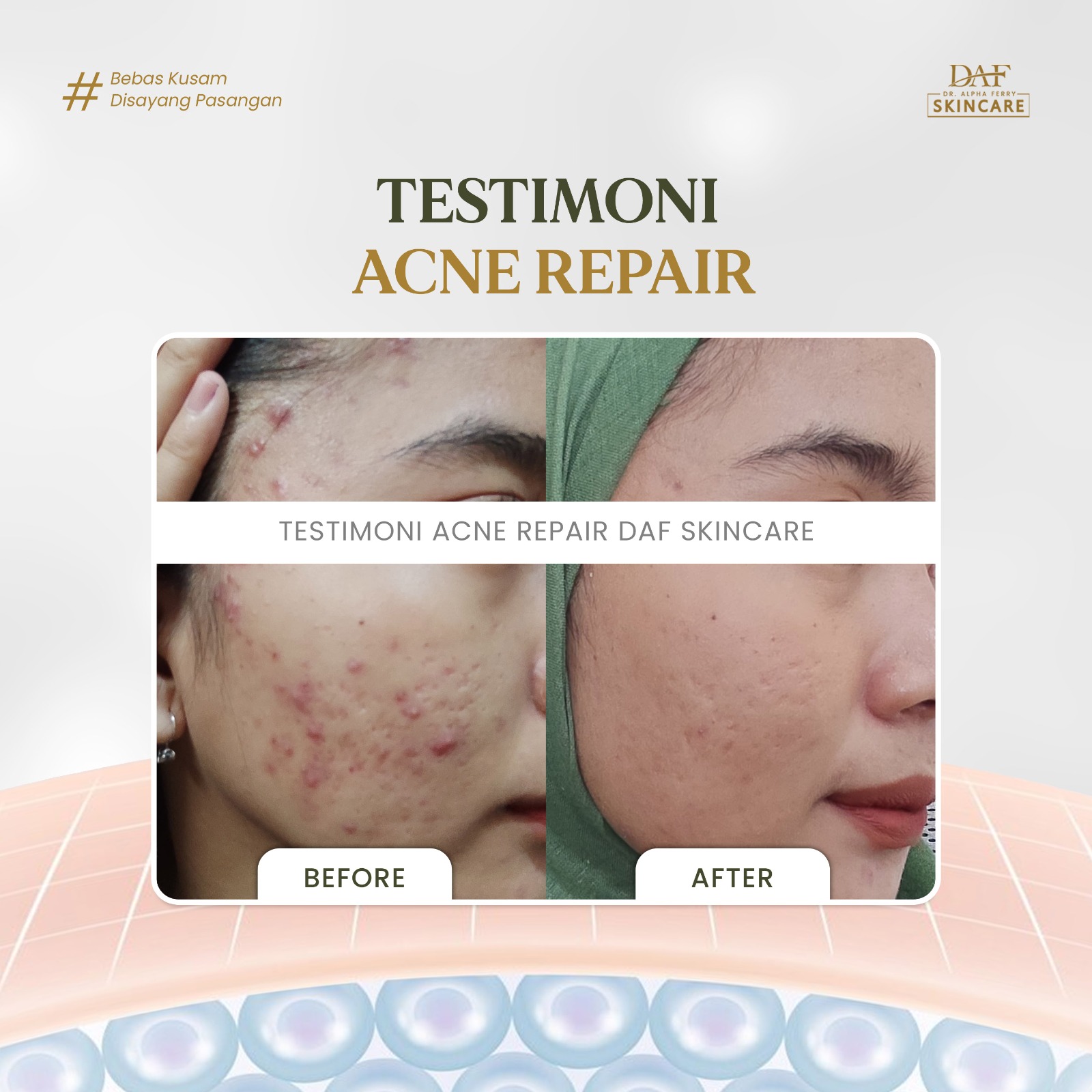 Tekstur kulit yang terhidrasi dengan pantulan cahaya lembut