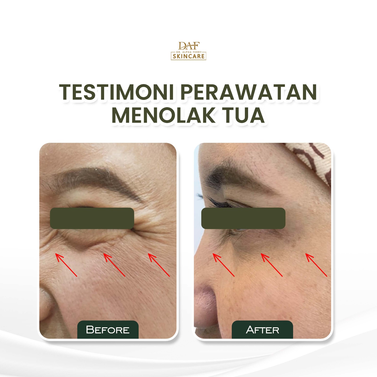 Tekstur kulit dengan warna yang lebih merata